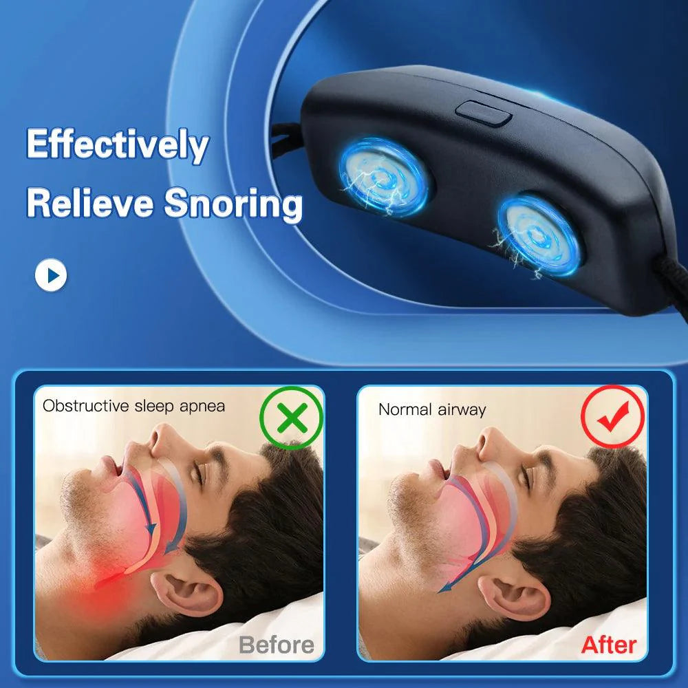 PulseSilence EMS Snore Stopper for Sleep Optimization