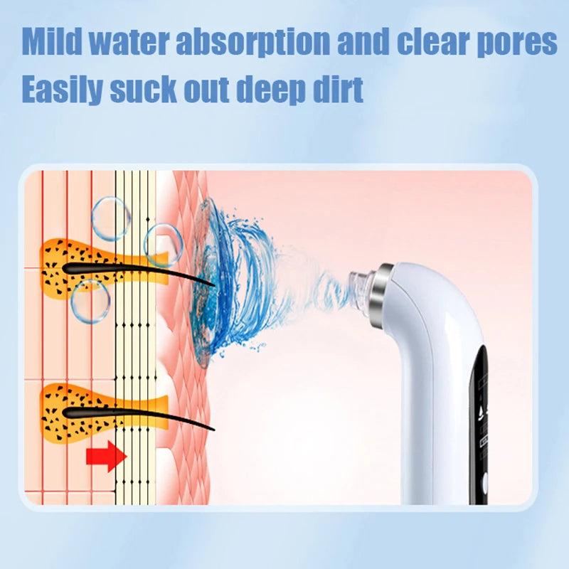 Aurora PoreVac Pro Blackhead Remover For Deep Cleaning