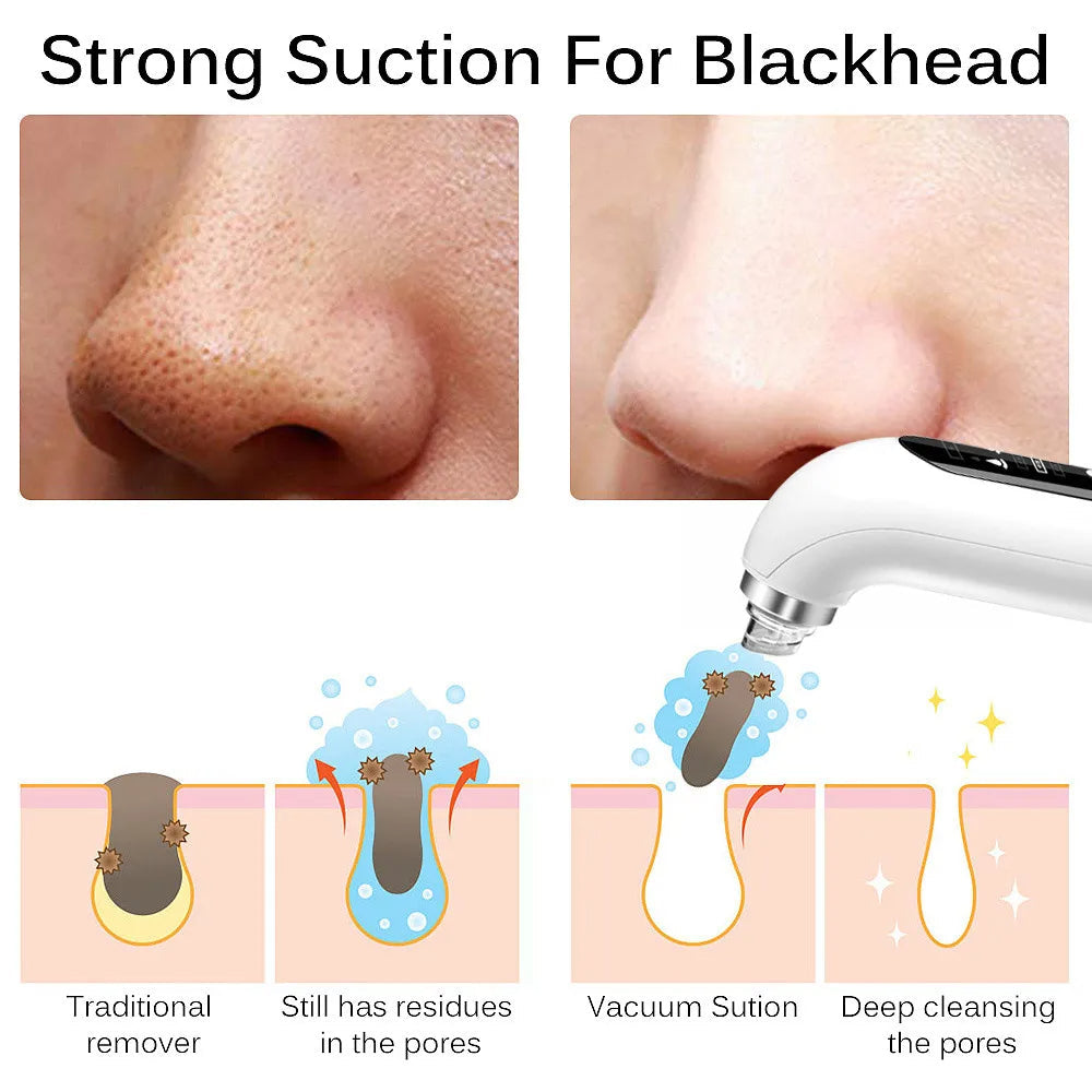 Aurora PoreVac Pro Blackhead Remover For Deep Cleaning