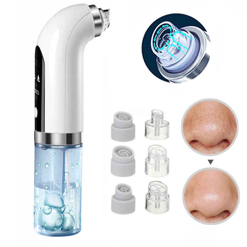 Aurora PoreVac Pro Blackhead Remover For Deep Cleaning