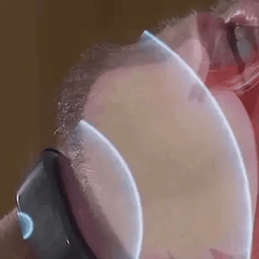 PulseSilence EMS Snore Stopper for Sleep Optimization