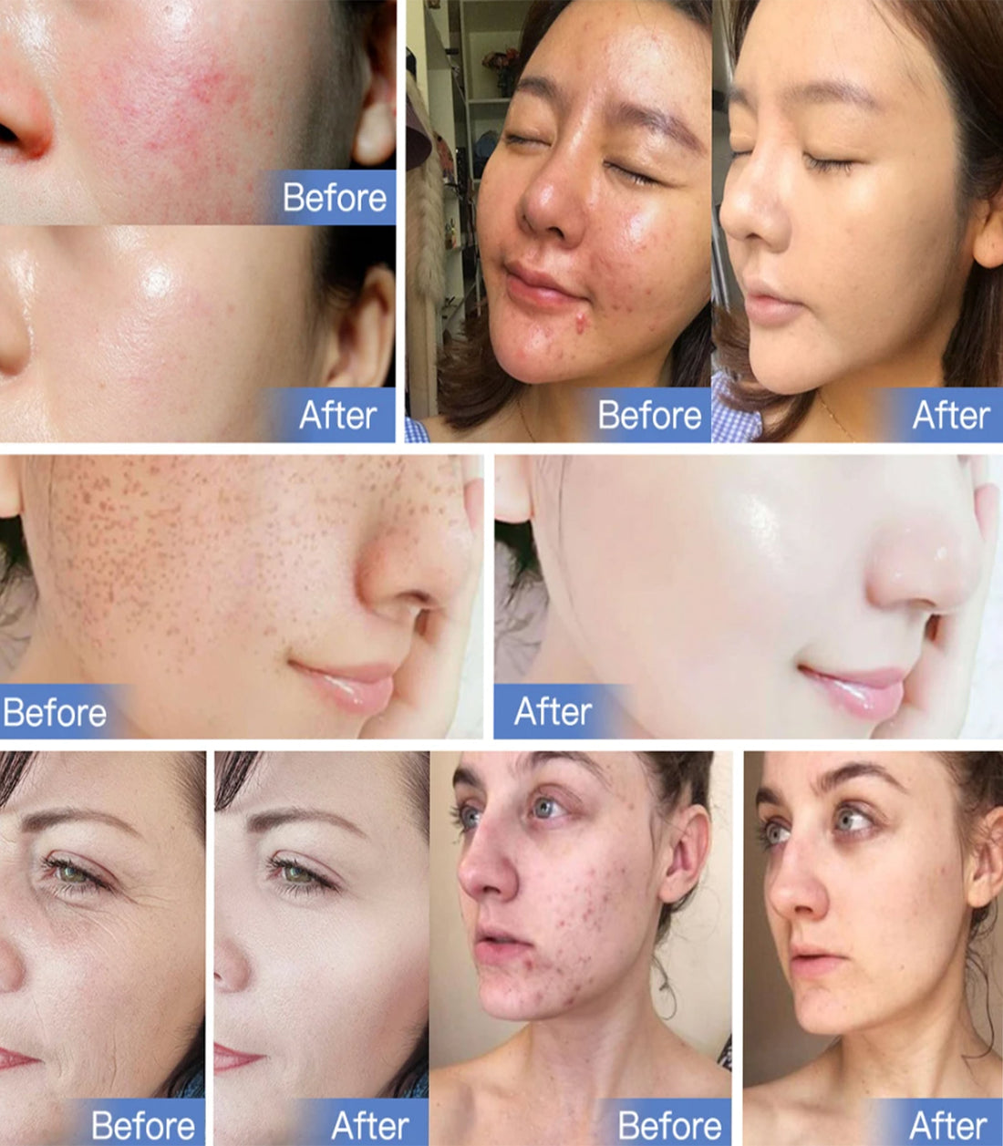 ViveGlow 7-Color LED Light Therapy Device for Radiant Skin