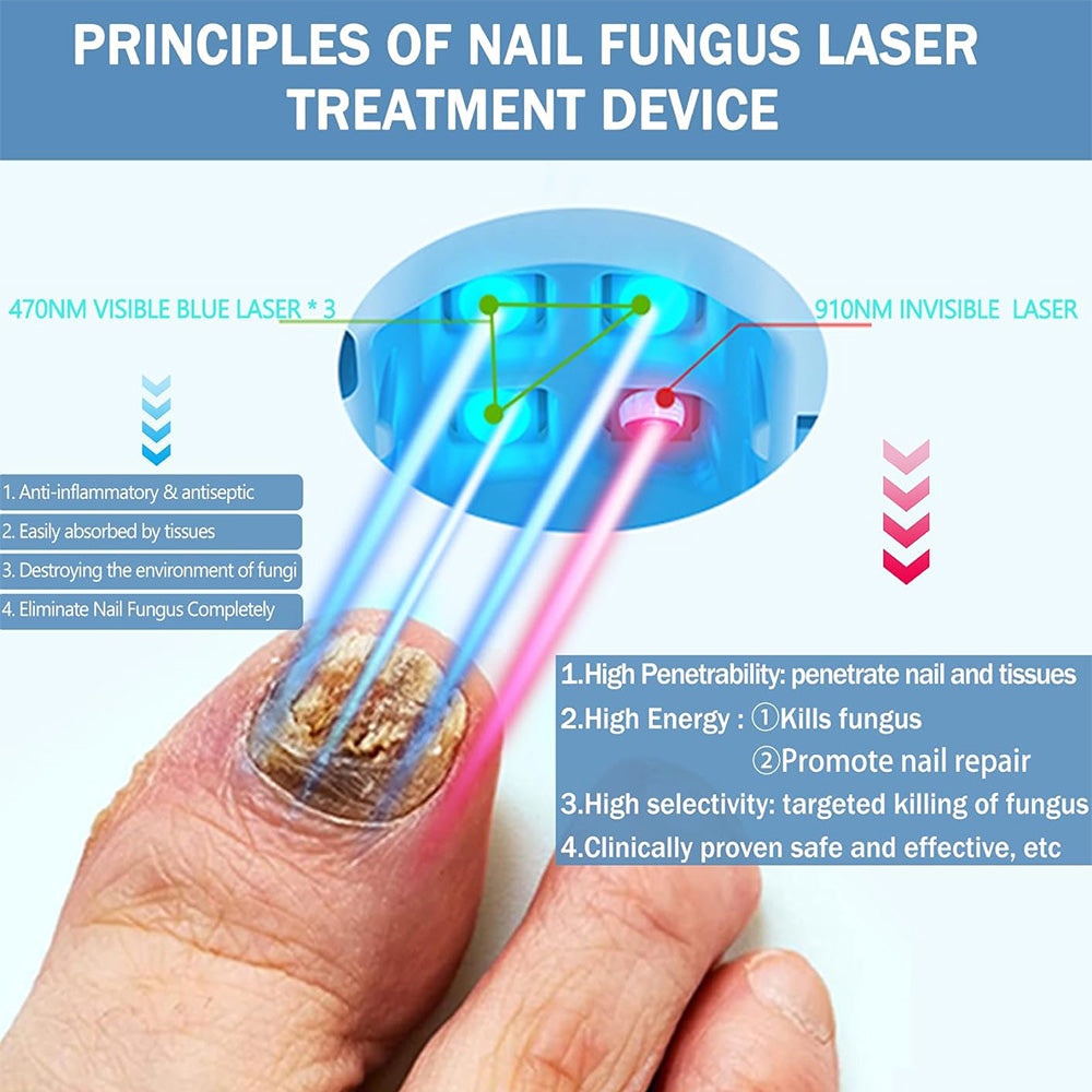 LumaFoot laser tåneglsopp behandlingsenhet for hjemmebruk