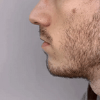 NovaNose Red Light Therapy for Nasal Congestion and Sinuses